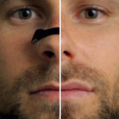 Airo Magnetic Nasal Strip Set - image 6 of 8